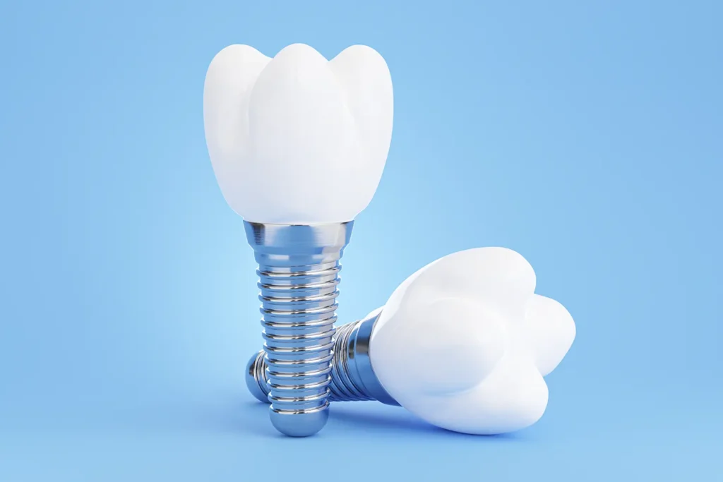 Dental Implants: Your Permanent Tooth Replacement Guide