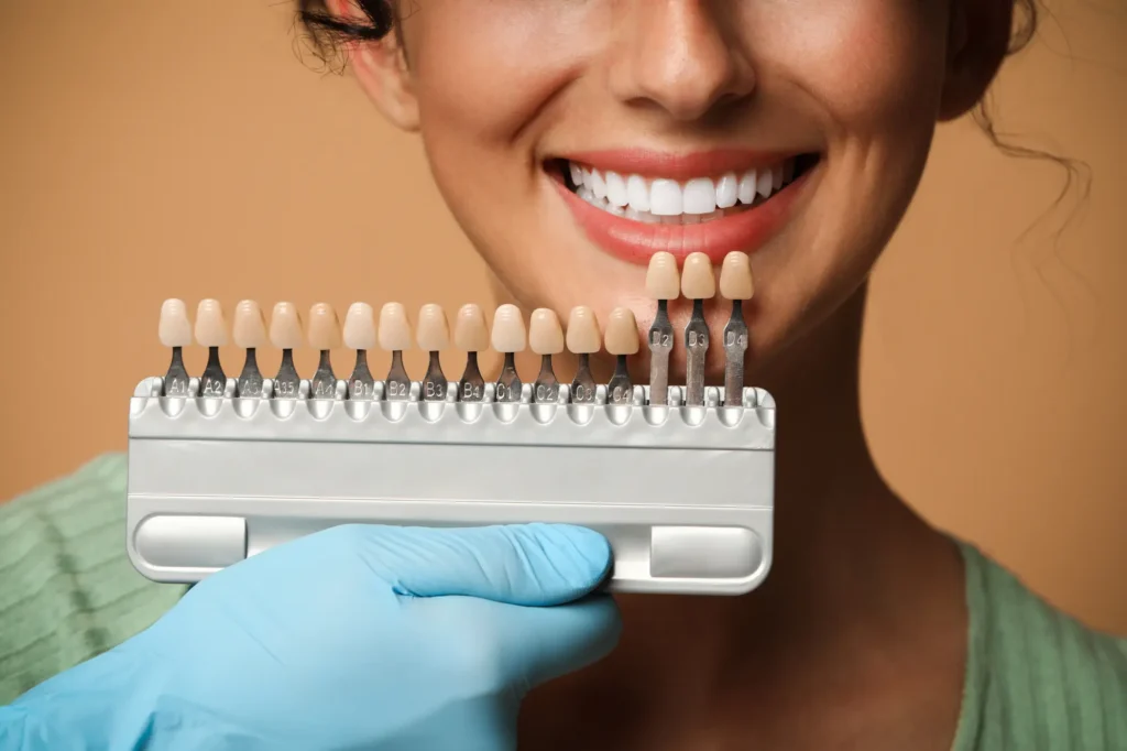 Why Digital Impressions Are Changing How We Place Porcelain Veneers