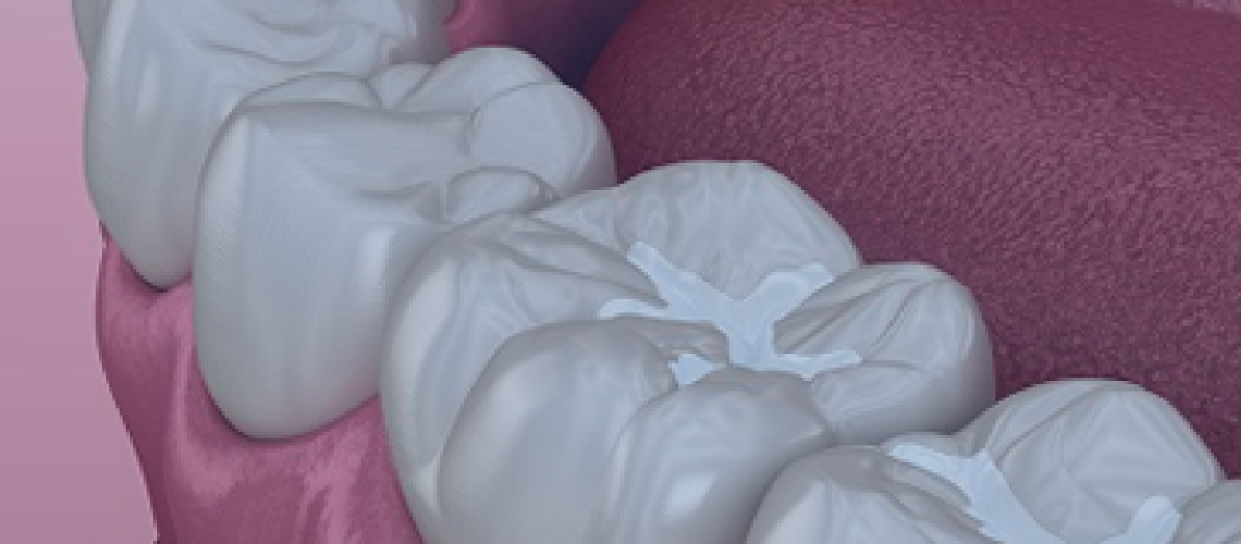 Aging and Oral Health